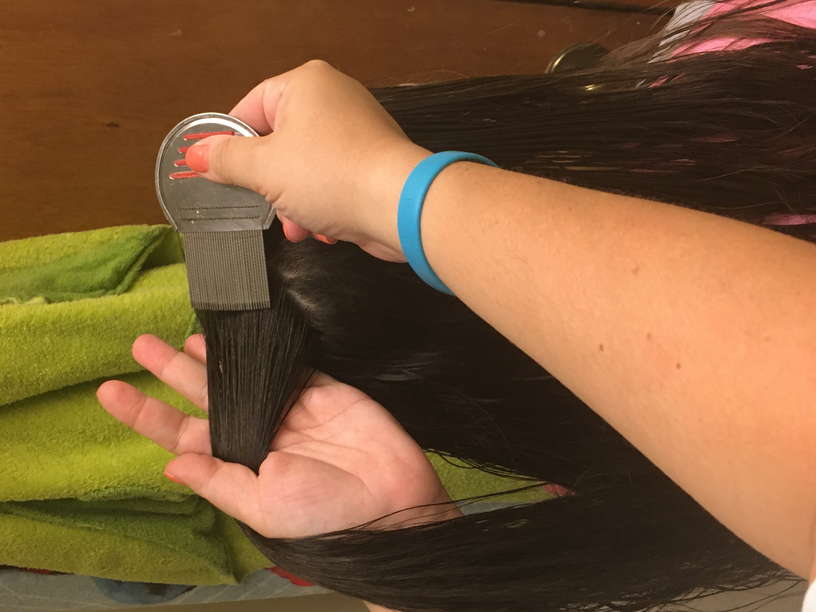 Head Lice Treatment Removal Service in Orlando, Florida LiceDoctors